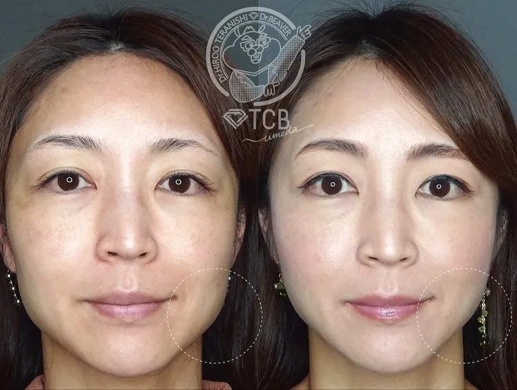 keisoku__case_content