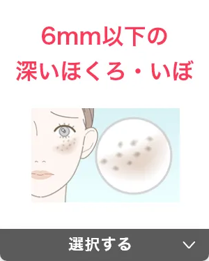 6mm以下の深いほくろ・いぼ