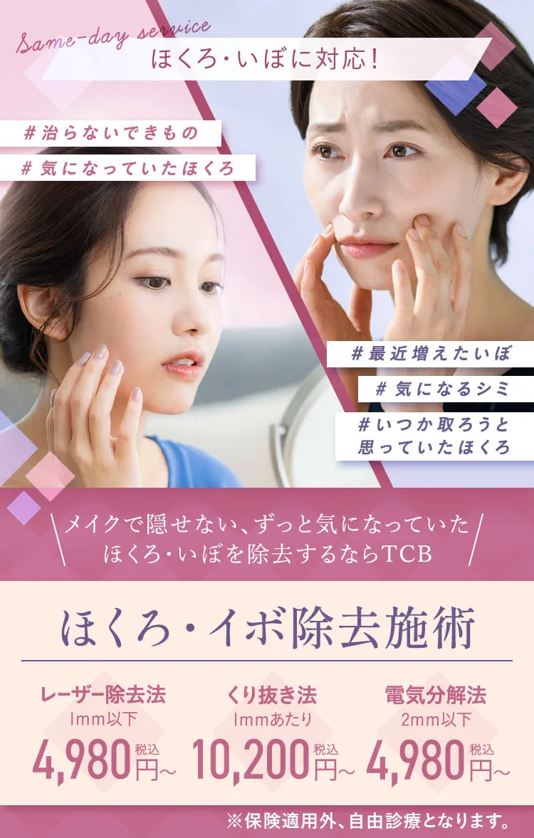 ほくろ・いぼを即日対応!TCB 1Day ほくろ・イボ除去施術