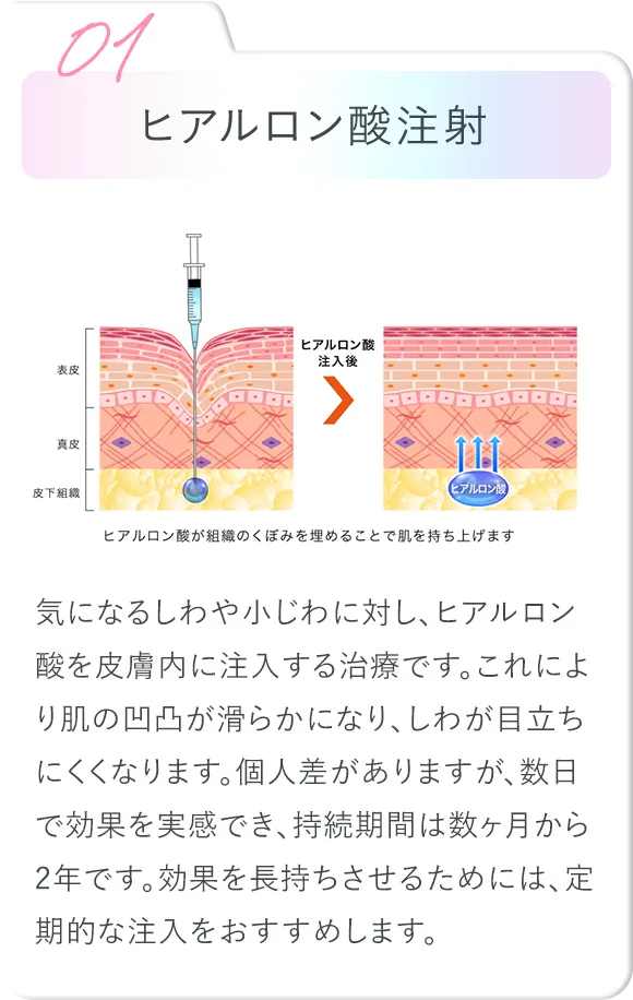 ヒアルロン酸注射