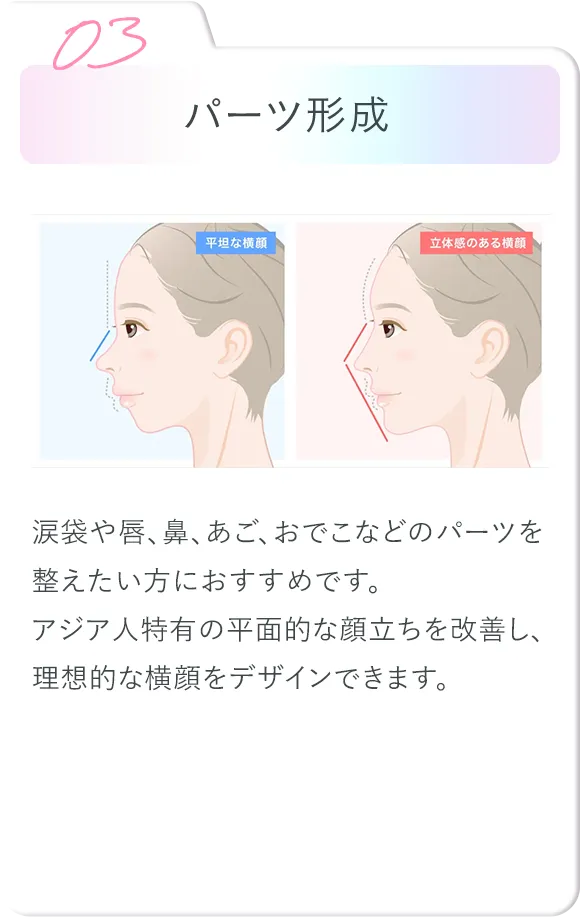 パーツ形成