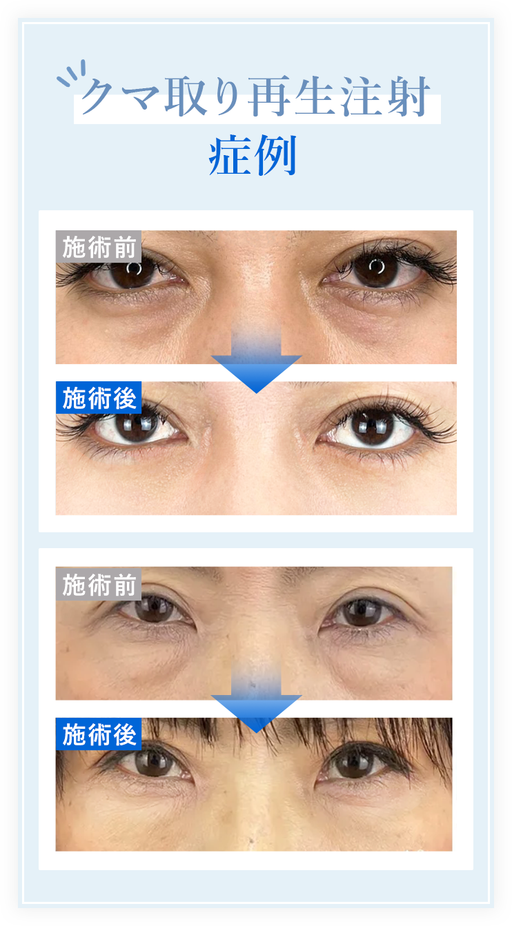 1度で実感できる