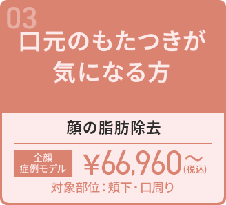 顔の脂肪除去