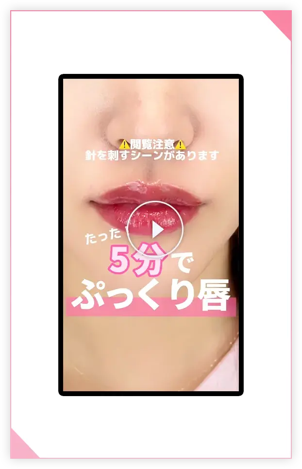 唇のヒアルロン酸注射の施術動画