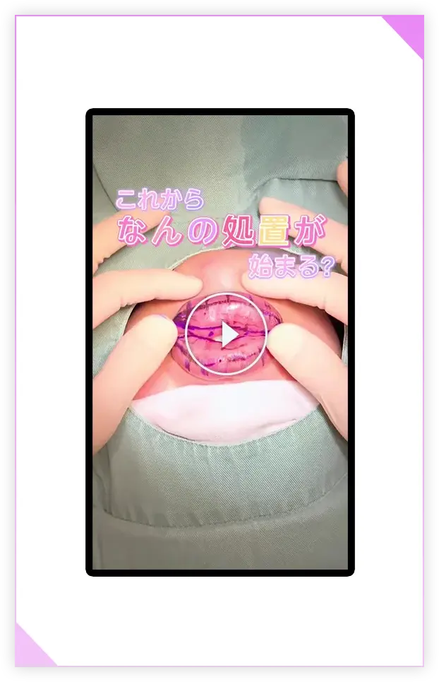スマートリップの施術動画