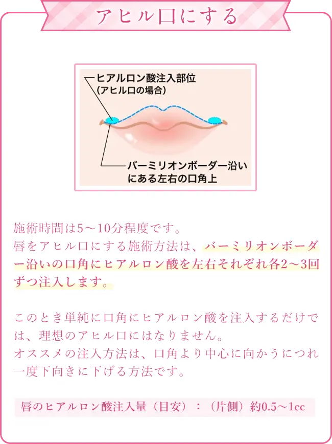 アヒル口にする