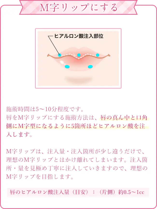 M字リップにする