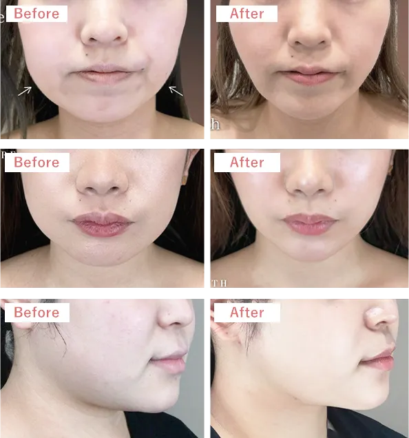 症例写真・ビフォーアフター