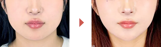 ビフォーアフター