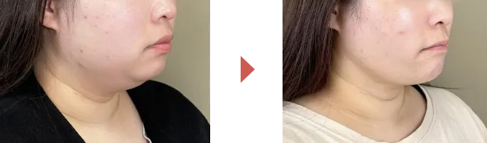 ビフォーアフター