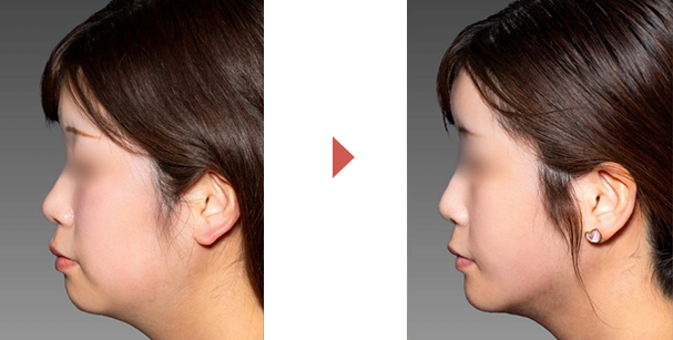 ビフォーアフター