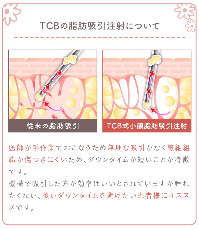 TCBの脂肪吸引注射について