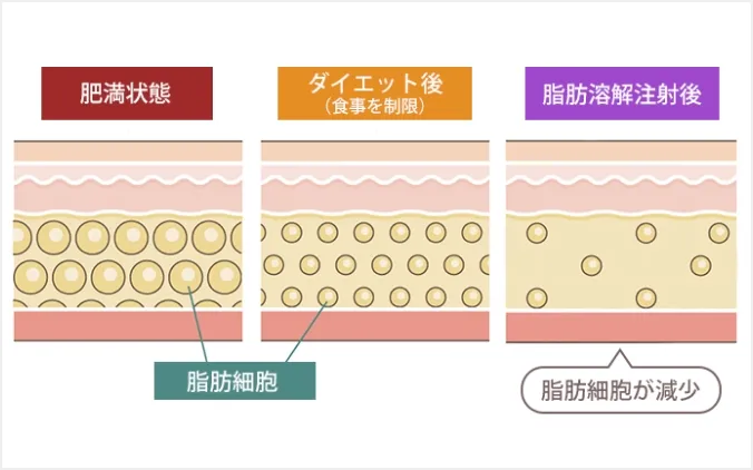 たるみを解消