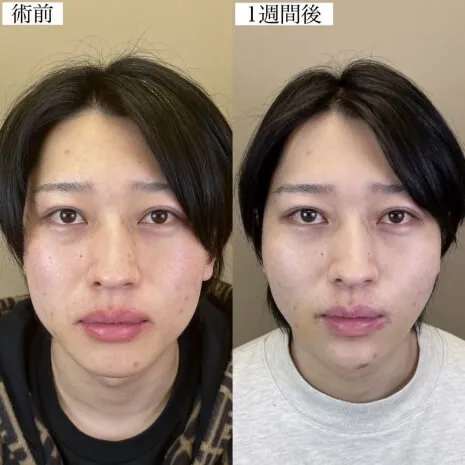 症例写真