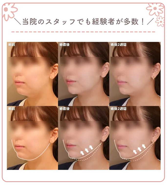 当院のスタッフでも経験者が多数!