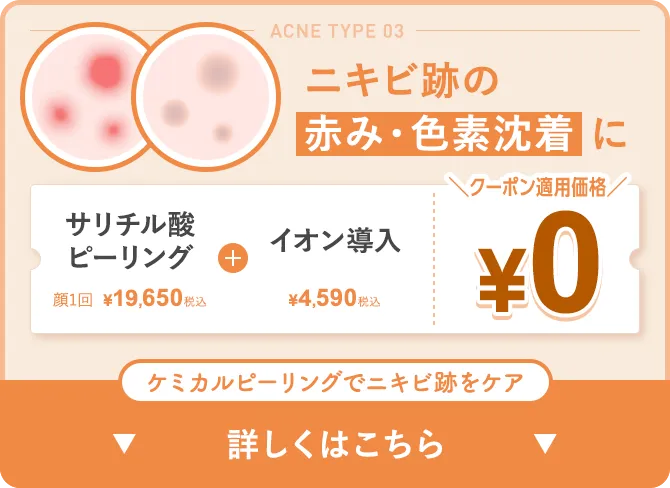 ニキビ跡の赤み・色素沈着に