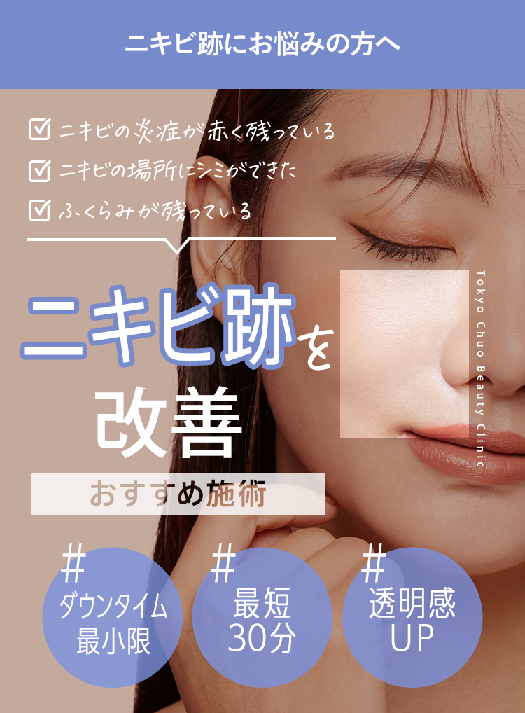 ニキビ跡を消す