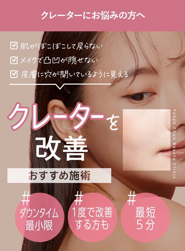 クレーターを治す