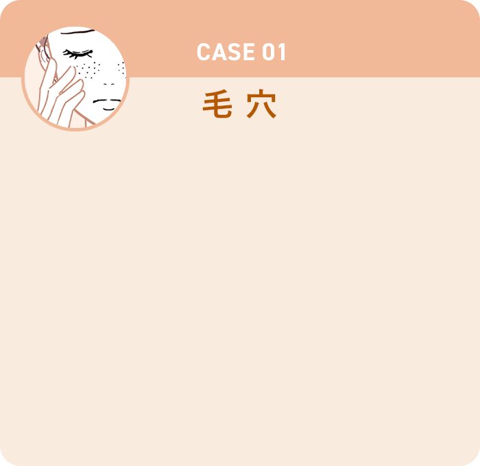 CASE01 毛穴