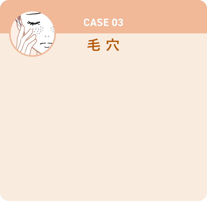 CASE01 毛穴