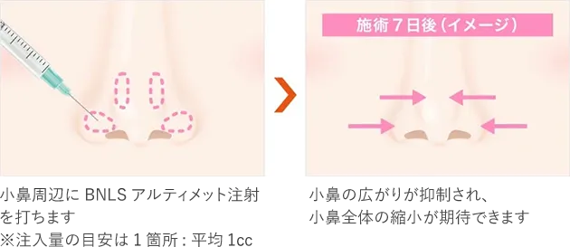 半永久的な効果、クオリティを求める方に！