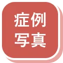 症例写真