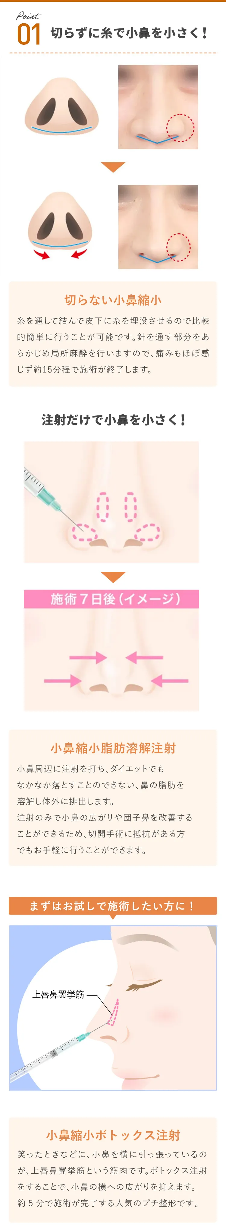 切らずに糸で小鼻を小さく!