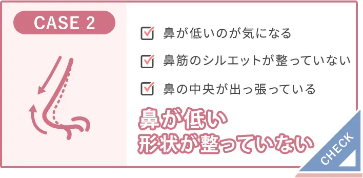 鼻が低い、形状が整っていない