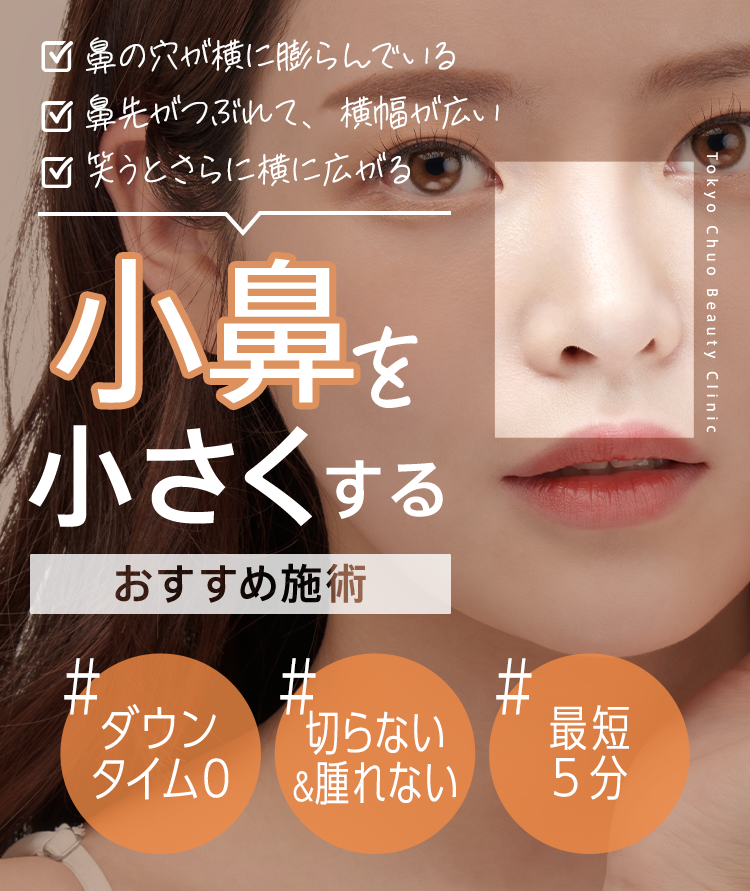 小鼻を小さくする