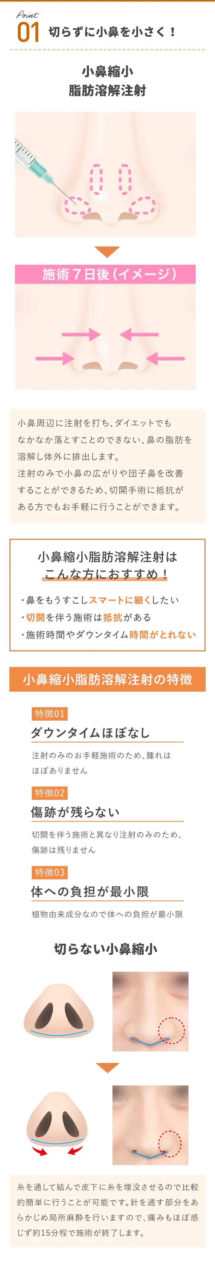 切らずに糸で小鼻を小さく!
