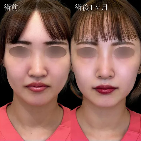 症例