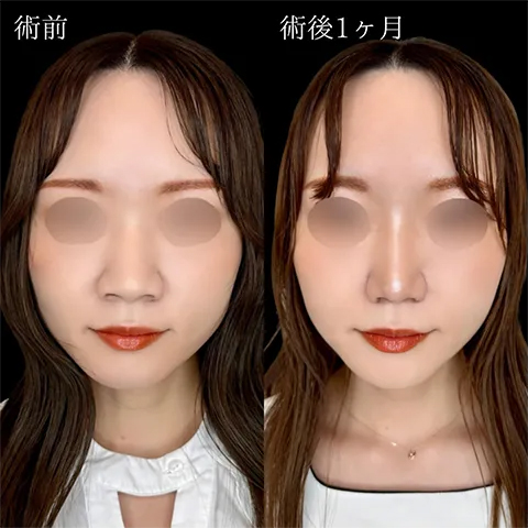 症例