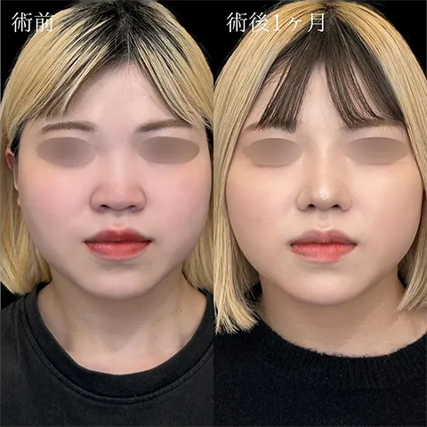症例