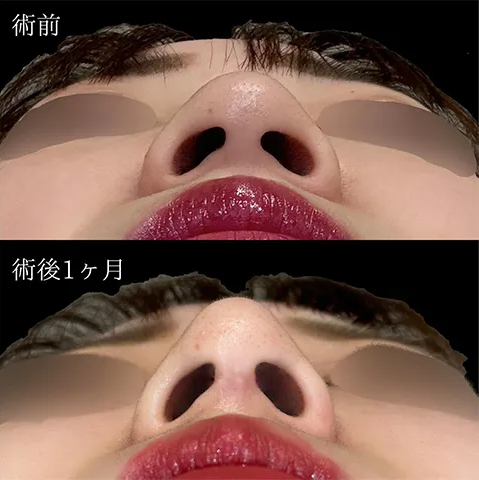 症例