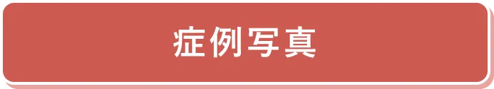 症例写真