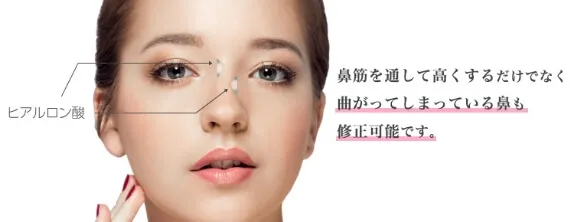鼻筋を通して高くするだけでなく曲がってしまっている鼻も修正可能です。