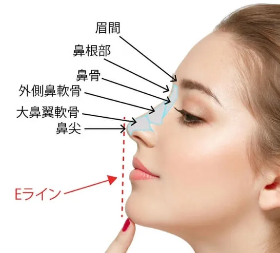 プロテーゼによる隆鼻術の説明