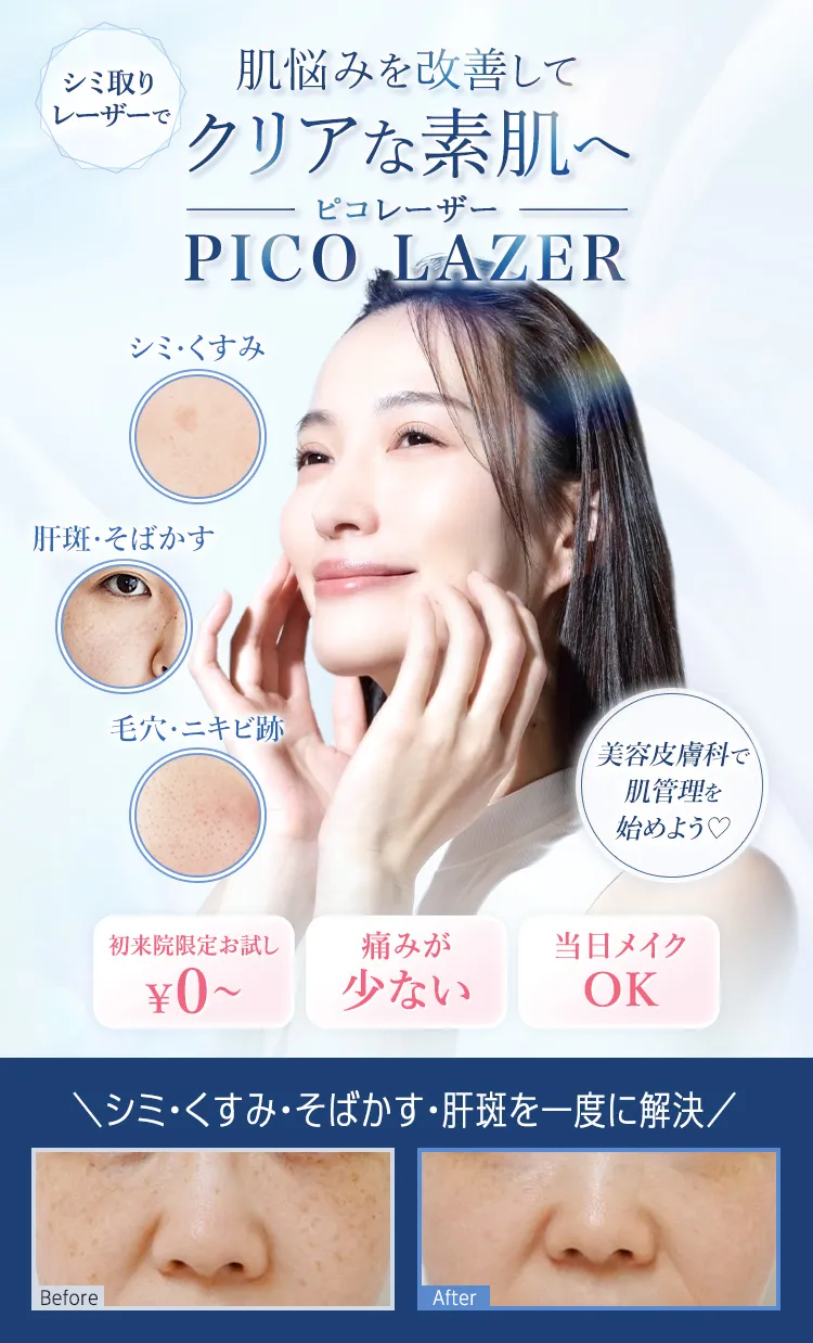 TCBでニキビ治療
