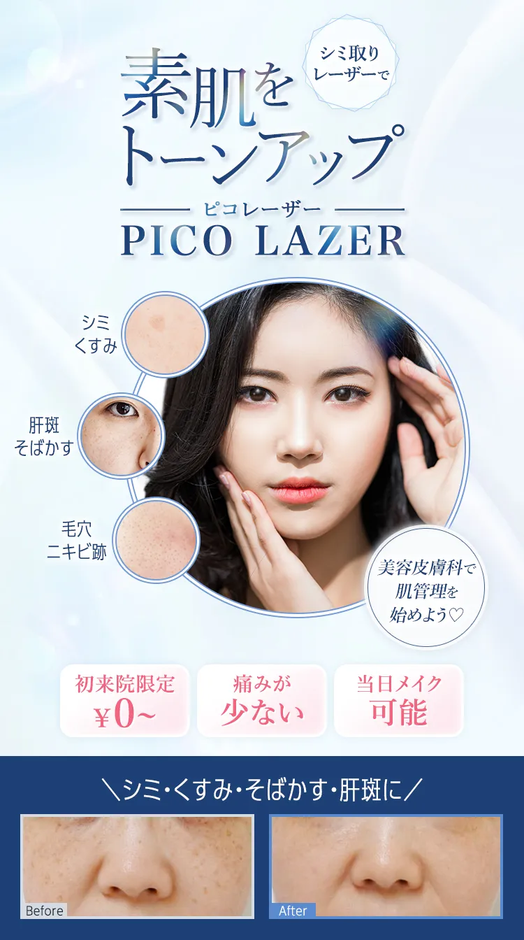 シミ取りレーザーで素肌をトーンアップ