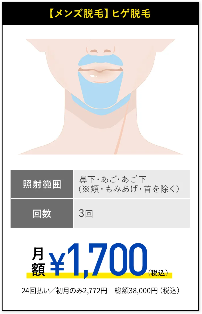 メンズ脱毛、ヒゲ脱毛オーダーメイド