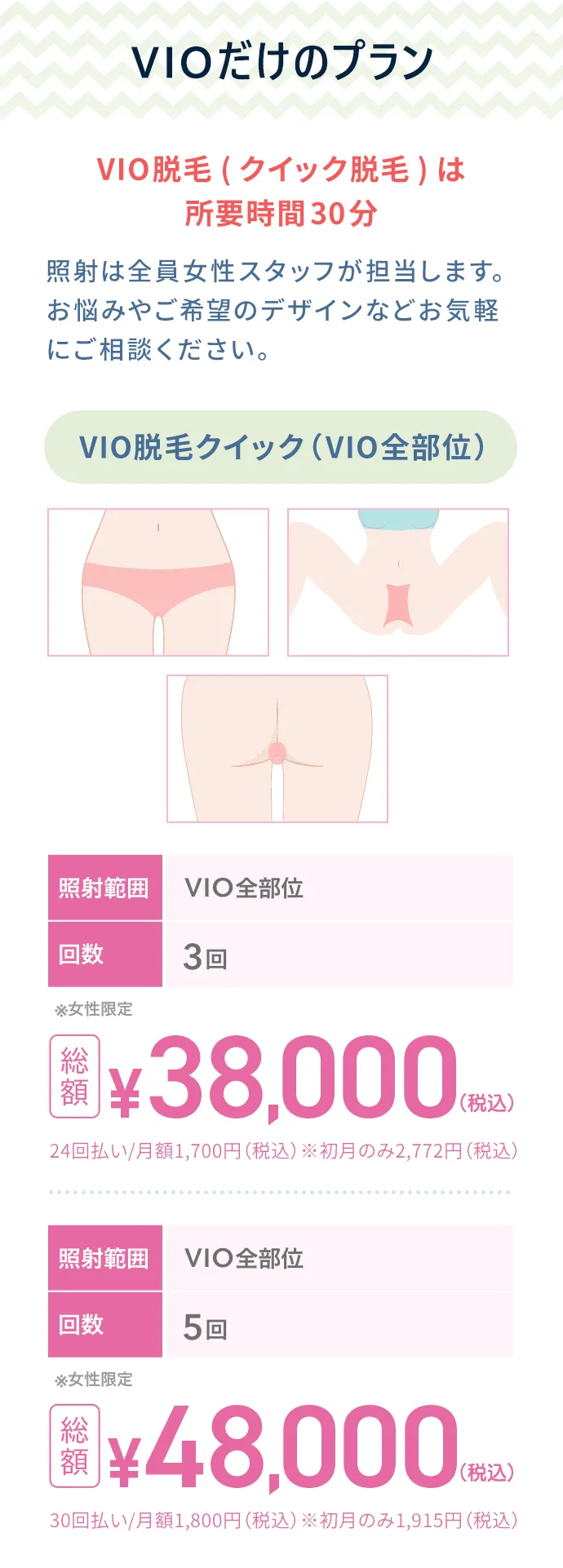 VIOだけのプラン