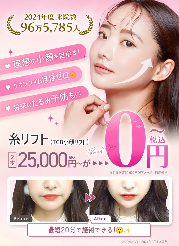 糸リフト（TCB式小顔リフト）