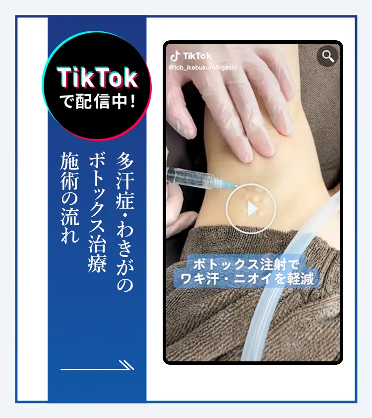 TikTokで配信中 ワキガ・多汗症解消注射 施術の流れ